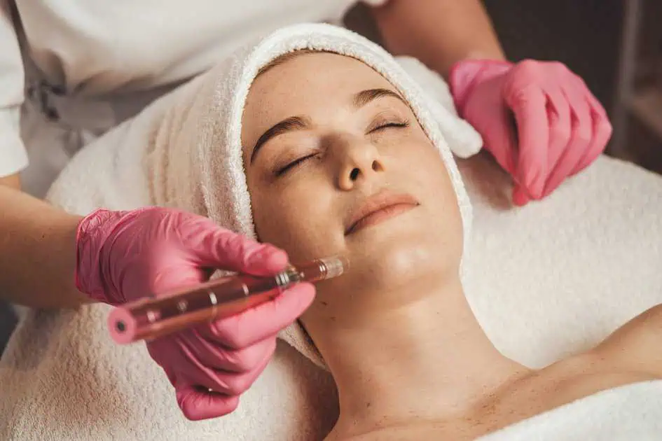 Microneedling Treatment In Oak Brook Terrace, IL by Arabella Boutique Med Spa