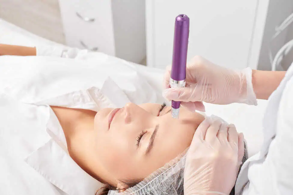 SkinPen Microneedling by Arabella Boutique Med Spa in Oakbrook Terrace, IL