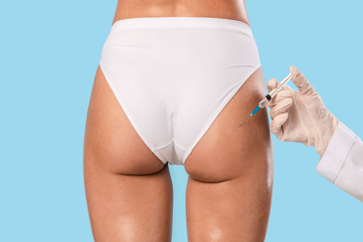 Radiesse Buttock Lift by Arabella Boutique Med Spa in Oakbrook Terrace IL